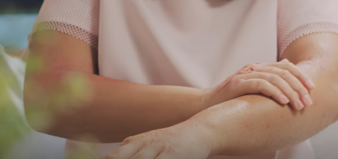 El Egzaması Hakkında Bilinmesi Gerekenler