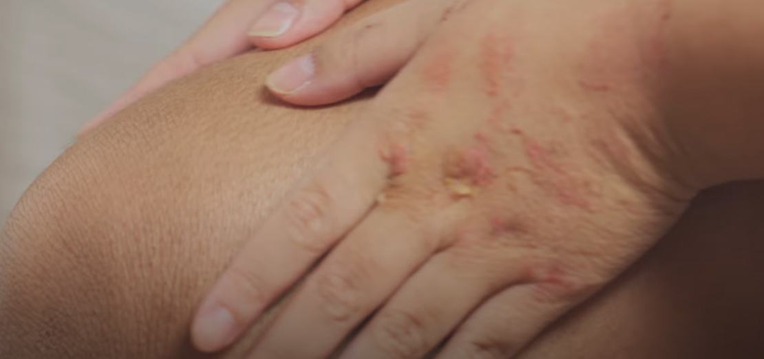 El Egzamasının İnsanlar Üzerindeki Olumsuz Etkileri